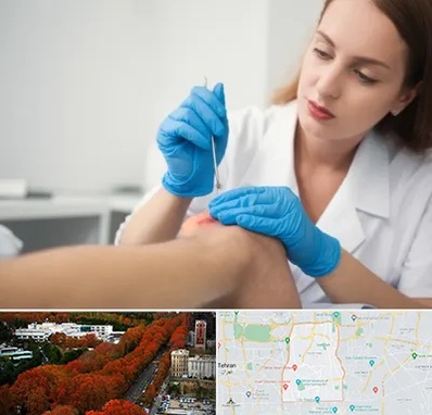 متخصص زخم در منطقه 6 تهران 