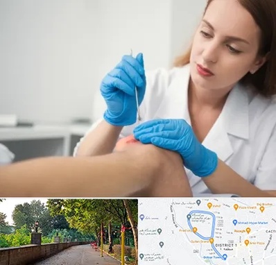 متخصص زخم در فلکه گاز رشت 