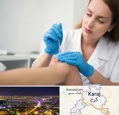 متخصص زخم در کرج