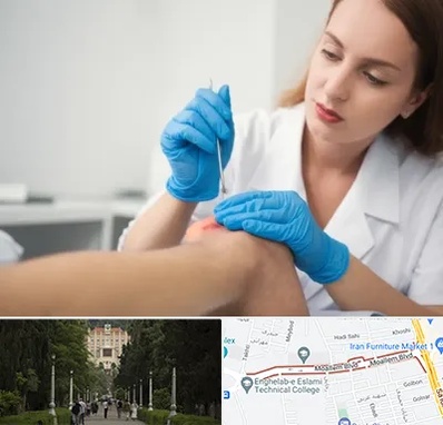 متخصص زخم در بلوار معلم رشت 