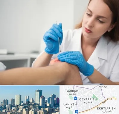 متخصص زخم در قیطریه 