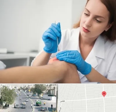 متخصص زخم در هاشمی