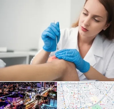 متخصص زخم در منظریه رشت 