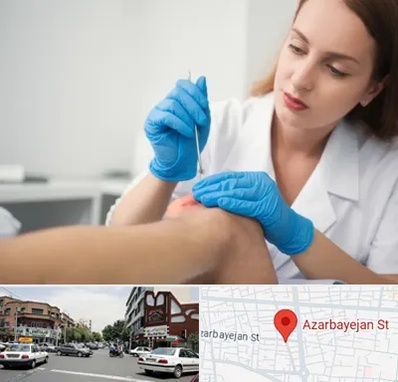متخصص زخم در خیابان آذربایجان 