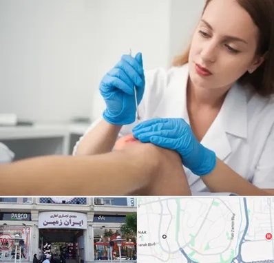 متخصص زخم در ایران زمین 