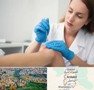 متخصص زخم در اردبیل