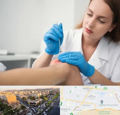 متخصص زخم در تهرانپارس 