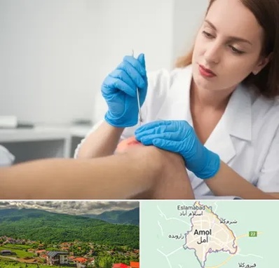 متخصص زخم در آمل