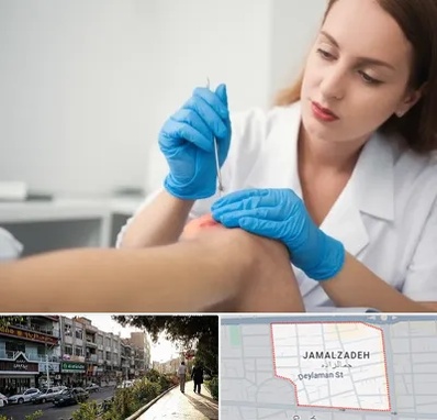 متخصص زخم در خیابان جمالزاده 