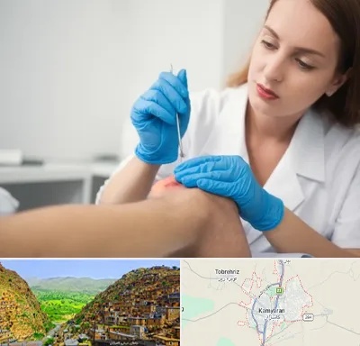 متخصص زخم در کامیاران