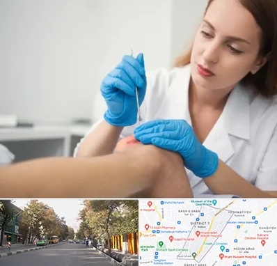 متخصص زخم در شریعتی 