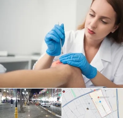 متخصص زخم در باغ فیض اسلامشهر 