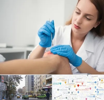 متخصص زخم در فاطمی 