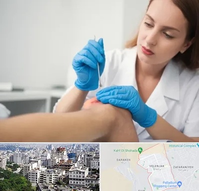 متخصص زخم در ولنجک 