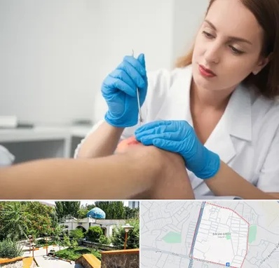 متخصص زخم در باغمیشه تبریز 