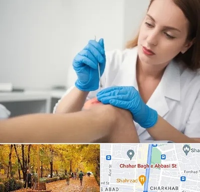 متخصص زخم در چهارباغ اصفهان 