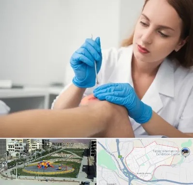 متخصص زخم در مرزداران تبریز 