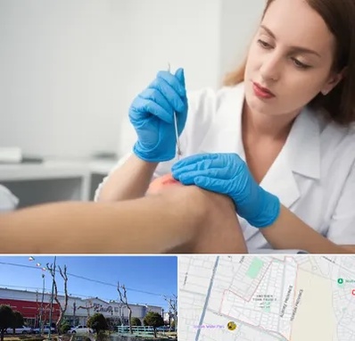 متخصص زخم در فاز دو اندیشه