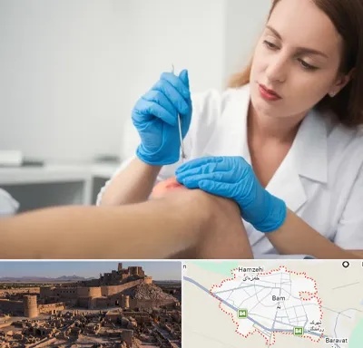 متخصص زخم در بم