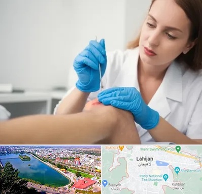 متخصص زخم در لاهیجان