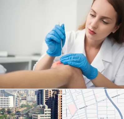 متخصص زخم در خیابان بهشتی 