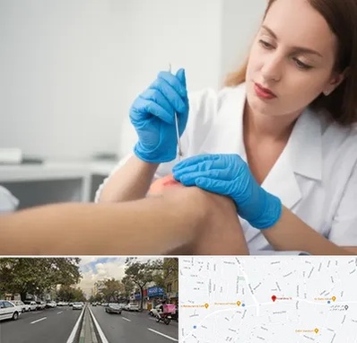 متخصص زخم در دولت 