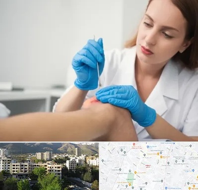 متخصص زخم در دیباجی 