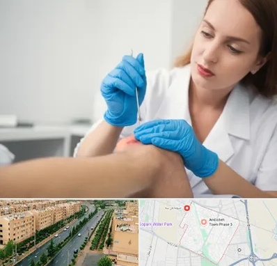 متخصص زخم در فاز سه اندیشه