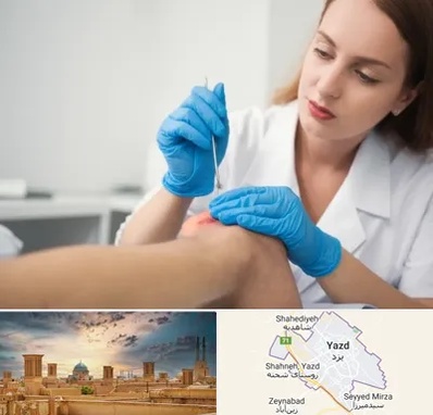 متخصص زخم در یزد