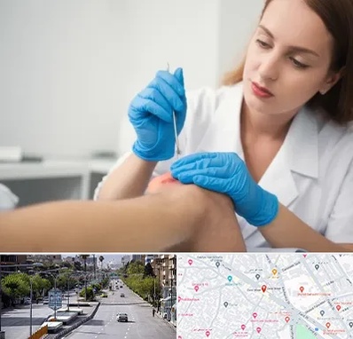 متخصص زخم در خیابان زند شیراز 