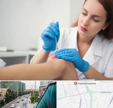 متخصص زخم در بلوار فرحزادی 