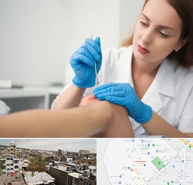 متخصص زخم در شمیران نو 