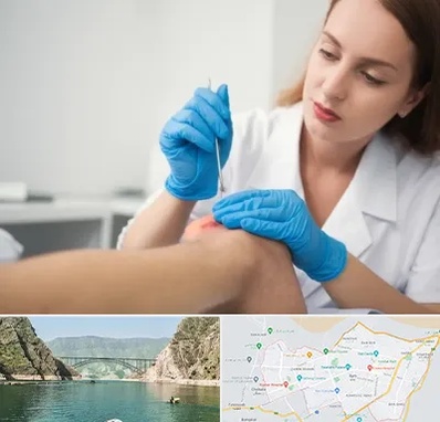 متخصص زخم در ایلام