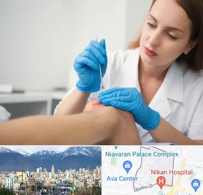 متخصص زخم در آجودانیه 