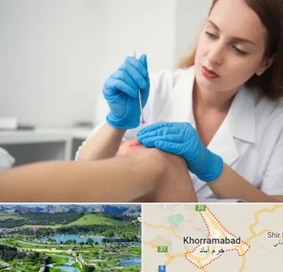 متخصص زخم در خرم آباد