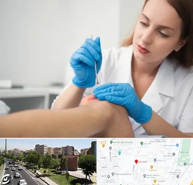 متخصص زخم در شهرک آزمایش 