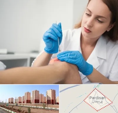 متخصص زخم در پردیسان قم 