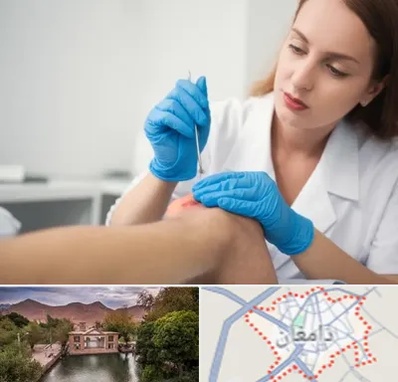 متخصص زخم در دامغان