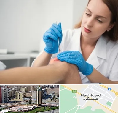 متخصص زخم در هشتگرد