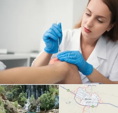 متخصص زخم در شیروان
