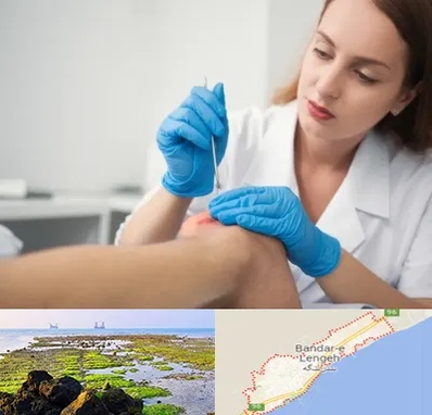 متخصص زخم در بندرلنگه