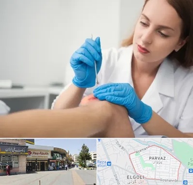 متخصص زخم در پرواز تبریز 