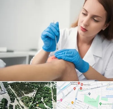 متخصص زخم در سالاریه قم 