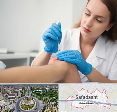 متخصص زخم در صفادشت