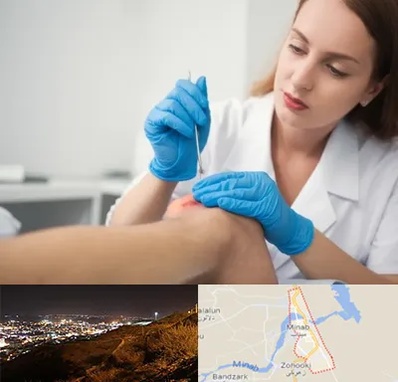 متخصص زخم در میناب