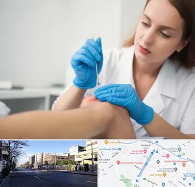 متخصص زخم در خیابان ملاصدرا شیراز 