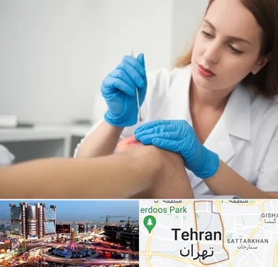 متخصص زخم در صادقیه 