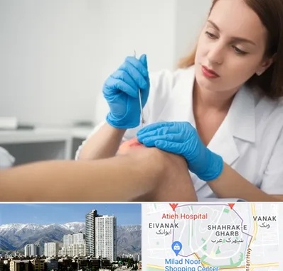 متخصص زخم در شهرک غرب 