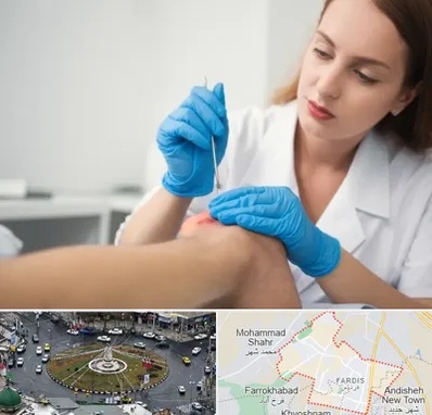 متخصص زخم در فردیس کرج 