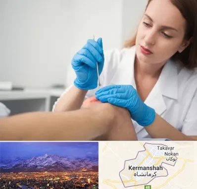 متخصص زخم در کرمانشاه